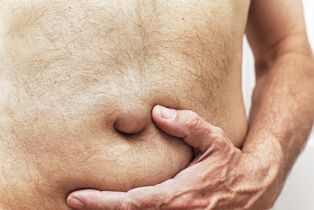 ¿Cuándo es grave un bulto abdominal rígido?