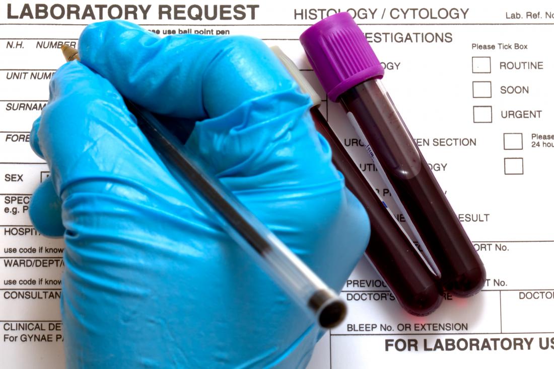 differential blood test paperwork from lab being filled out by gloved hand next to blood sample vials