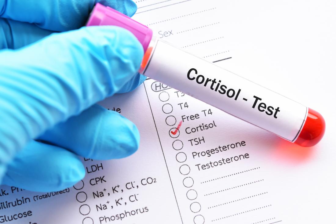 Corticosteroid Levels Test