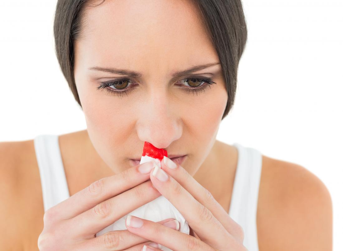 Nosebleeds at night Causes and home remedies