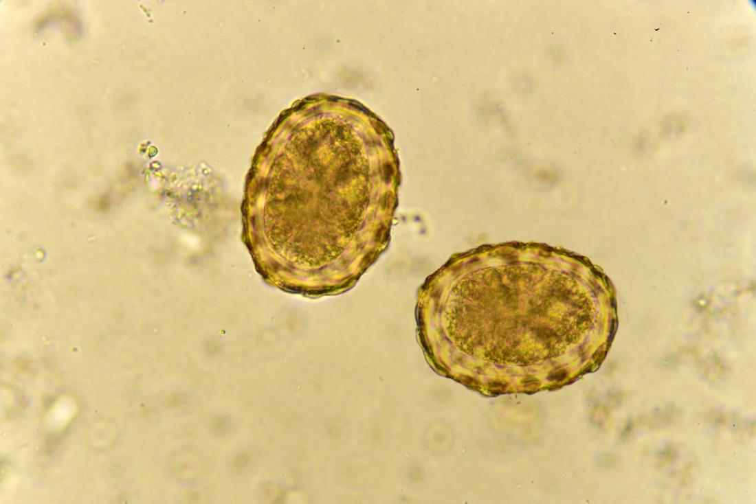 roundworms eggs in humans