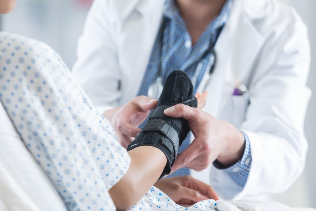 Broken (fractured) ankles: FAQs answered by a specialist