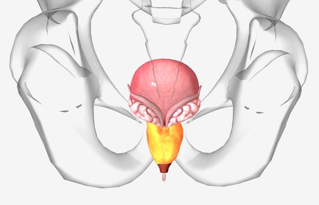 enlarged prostate gland