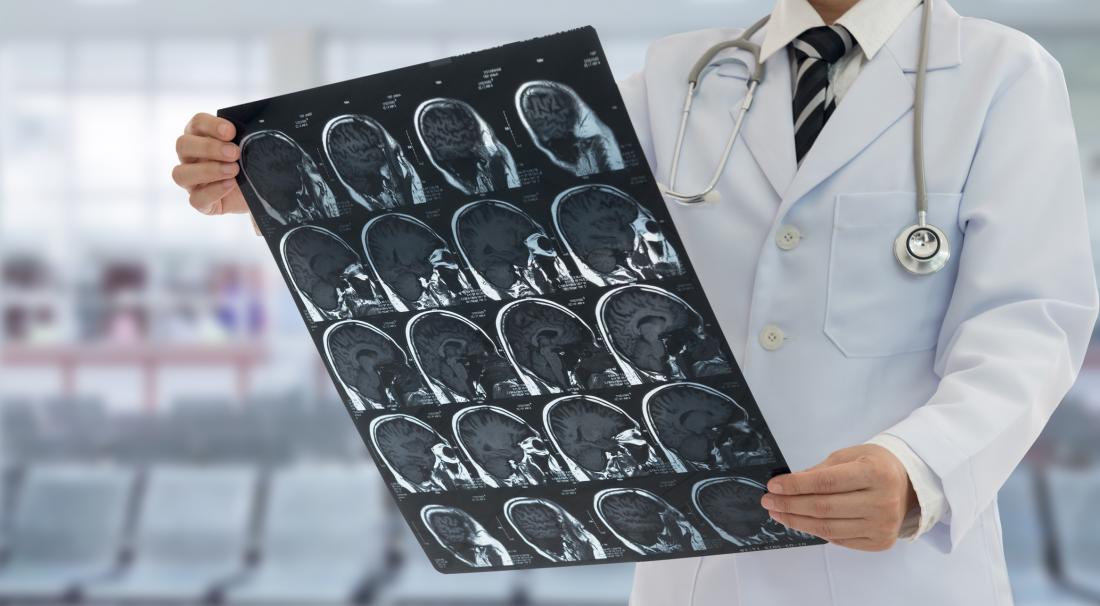 doctor looks at brain scan sheet
