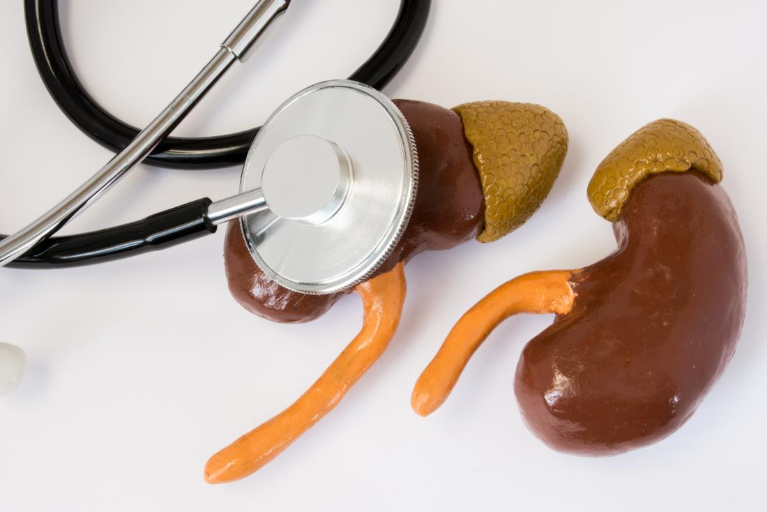 End-stage kidney disease represented by models of kidneys with stethoscope.