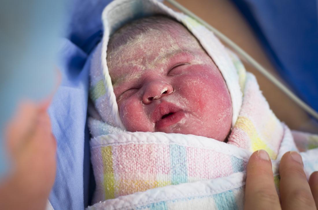 Giftig Påhængsmotor Musling Newborn skin peeling: Causes, treatment, and home remedies