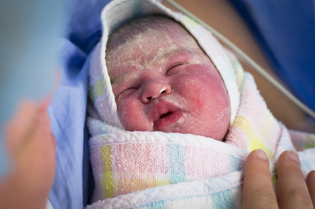 White stuff covering newborn clearance baby