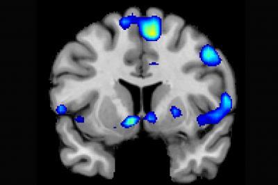 the nucleus accumbens