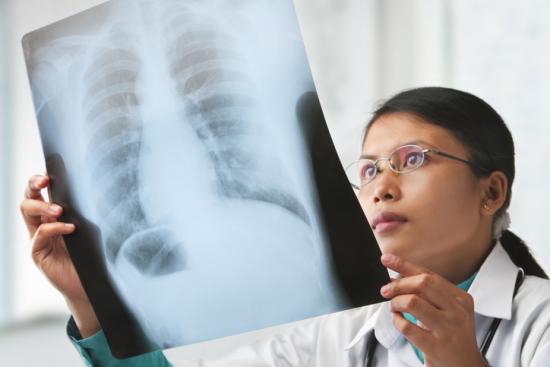 Doctor holding lung x-ray