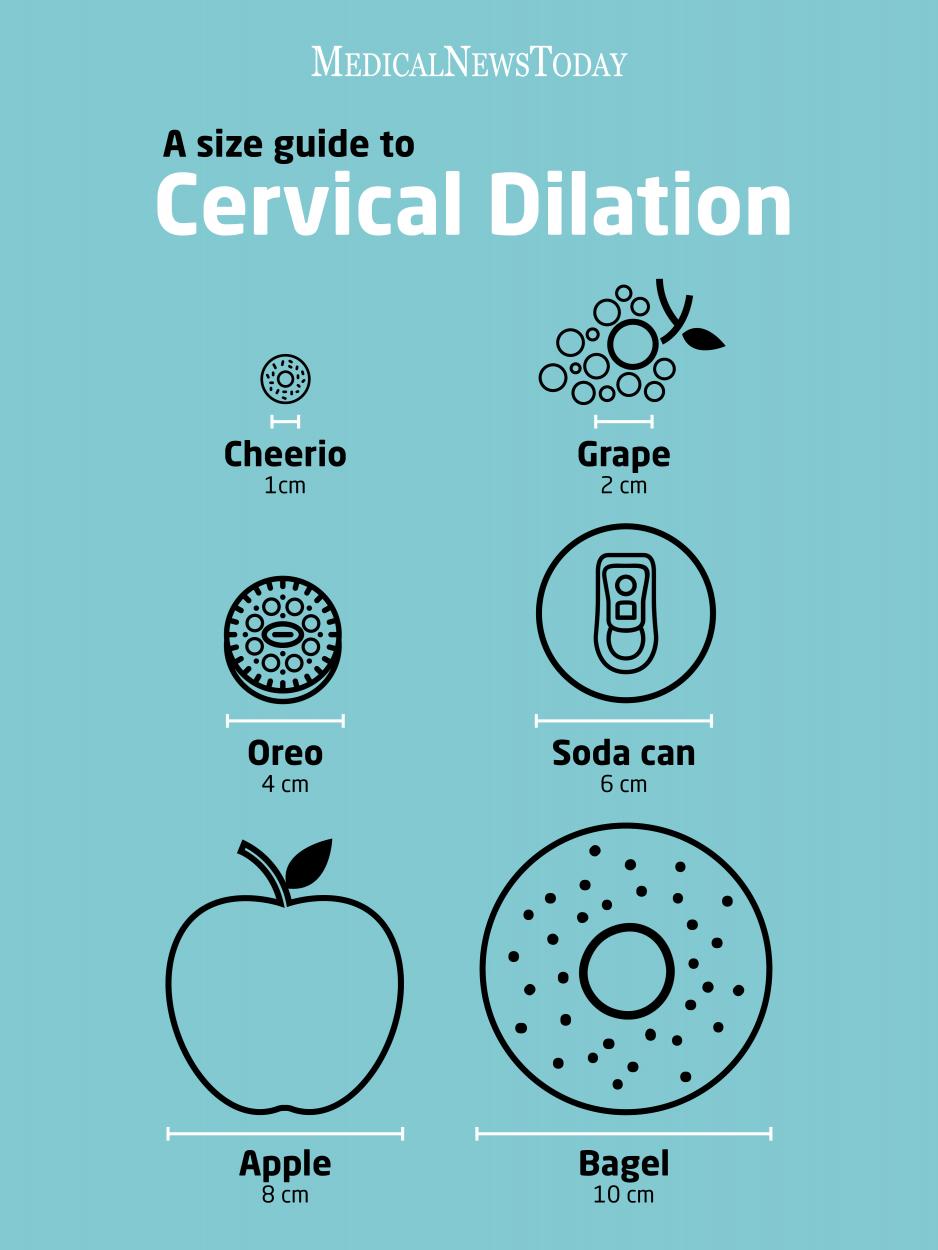 Cervical dilation chart