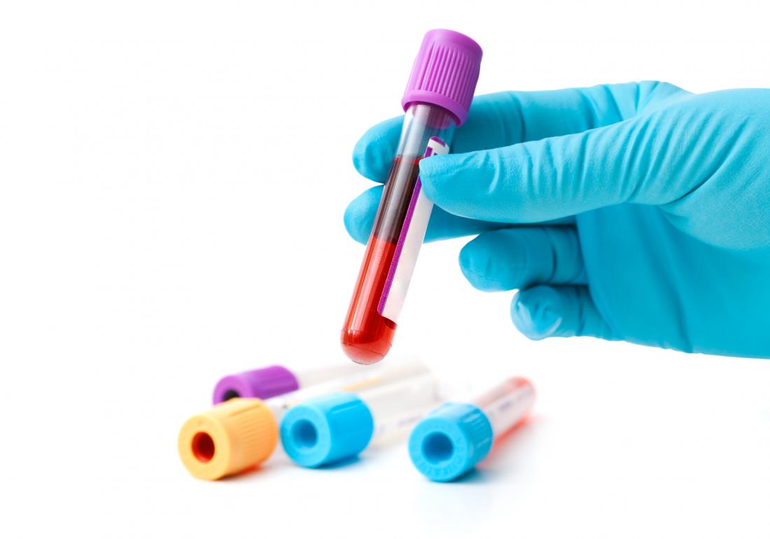 blood sample