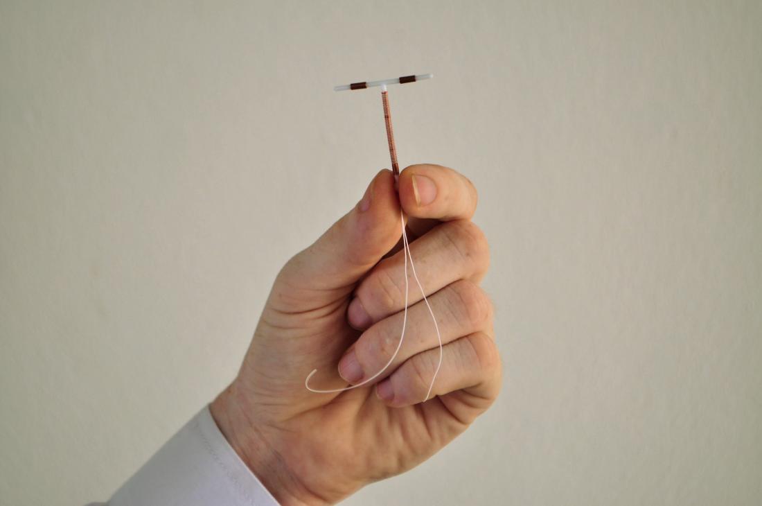 IUD side effects: What they are and how to manage them