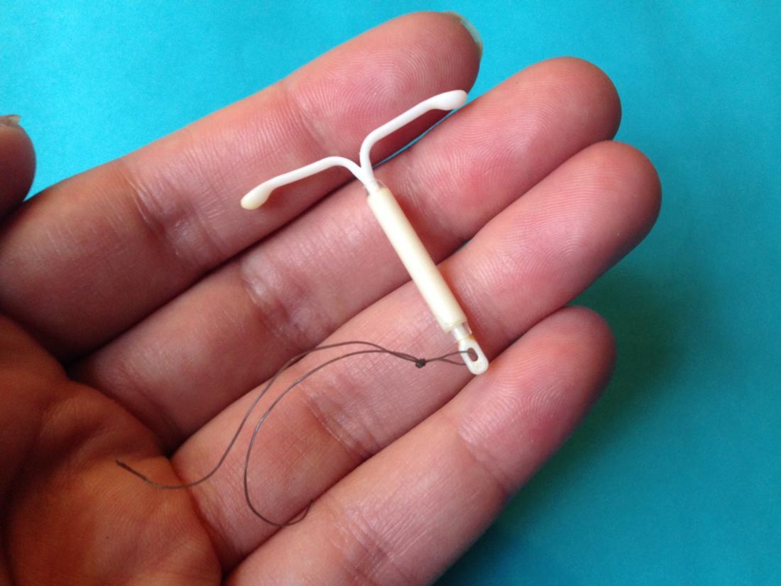 Can IUDs cause weight gain and what are the side effects