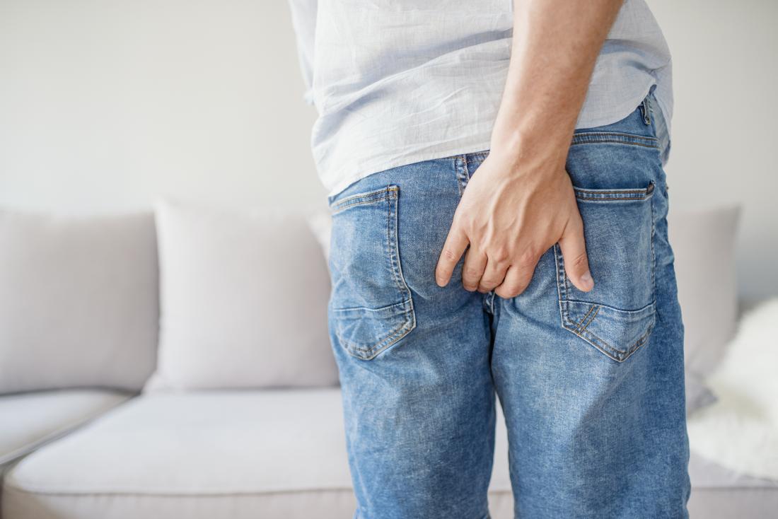 External hemorrhoids: Causes, symptoms, and treatments