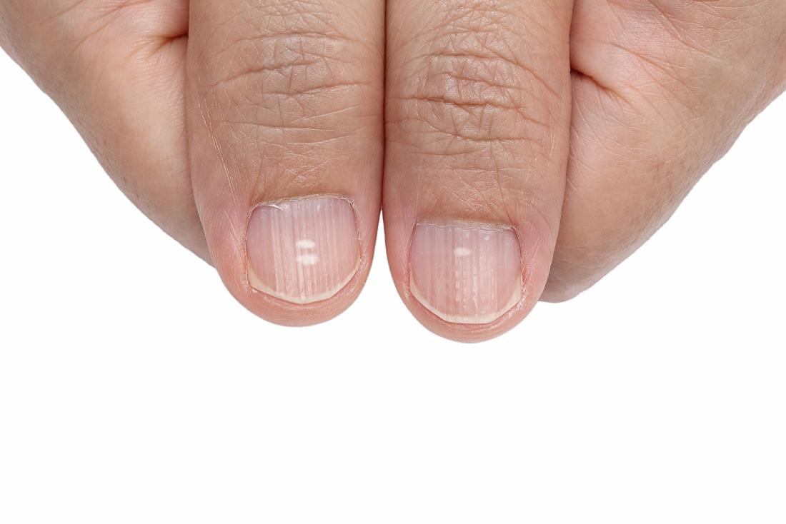 What your NAILS say about your health according to an expert  Daily Mail  Online