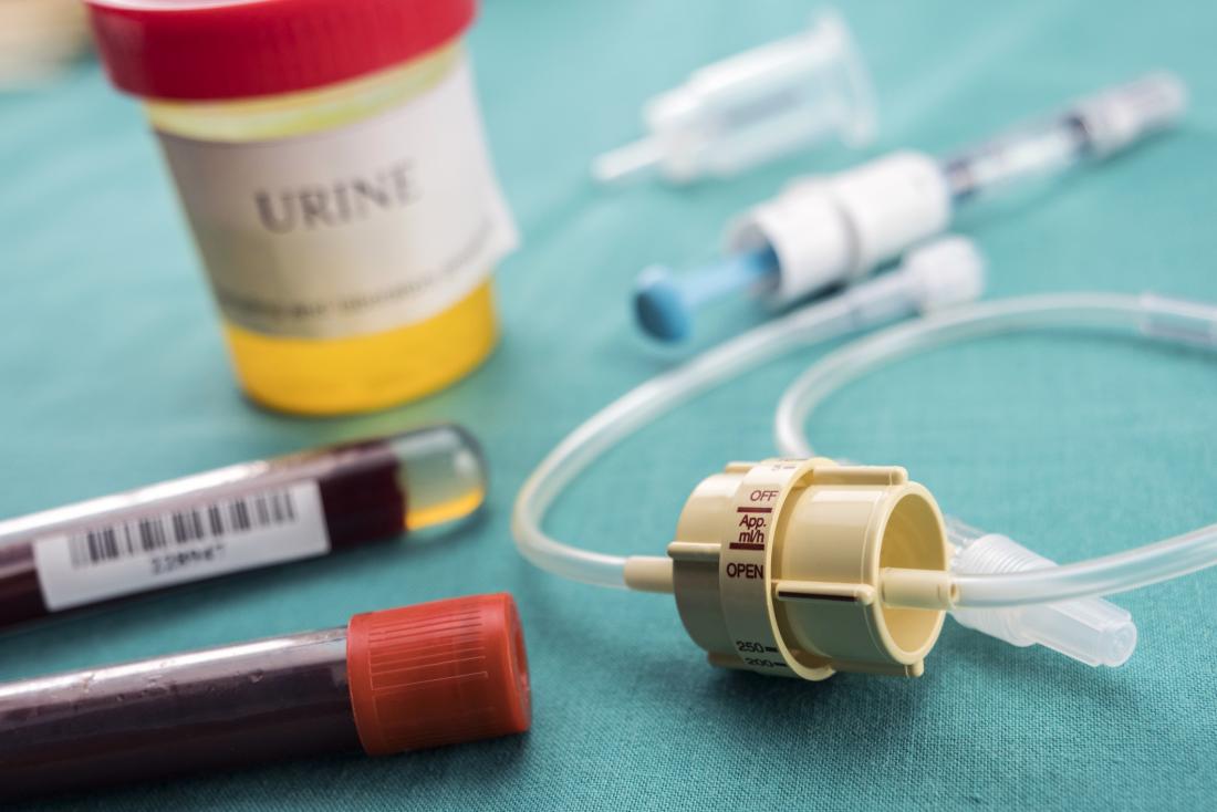 urine sample and blood samples