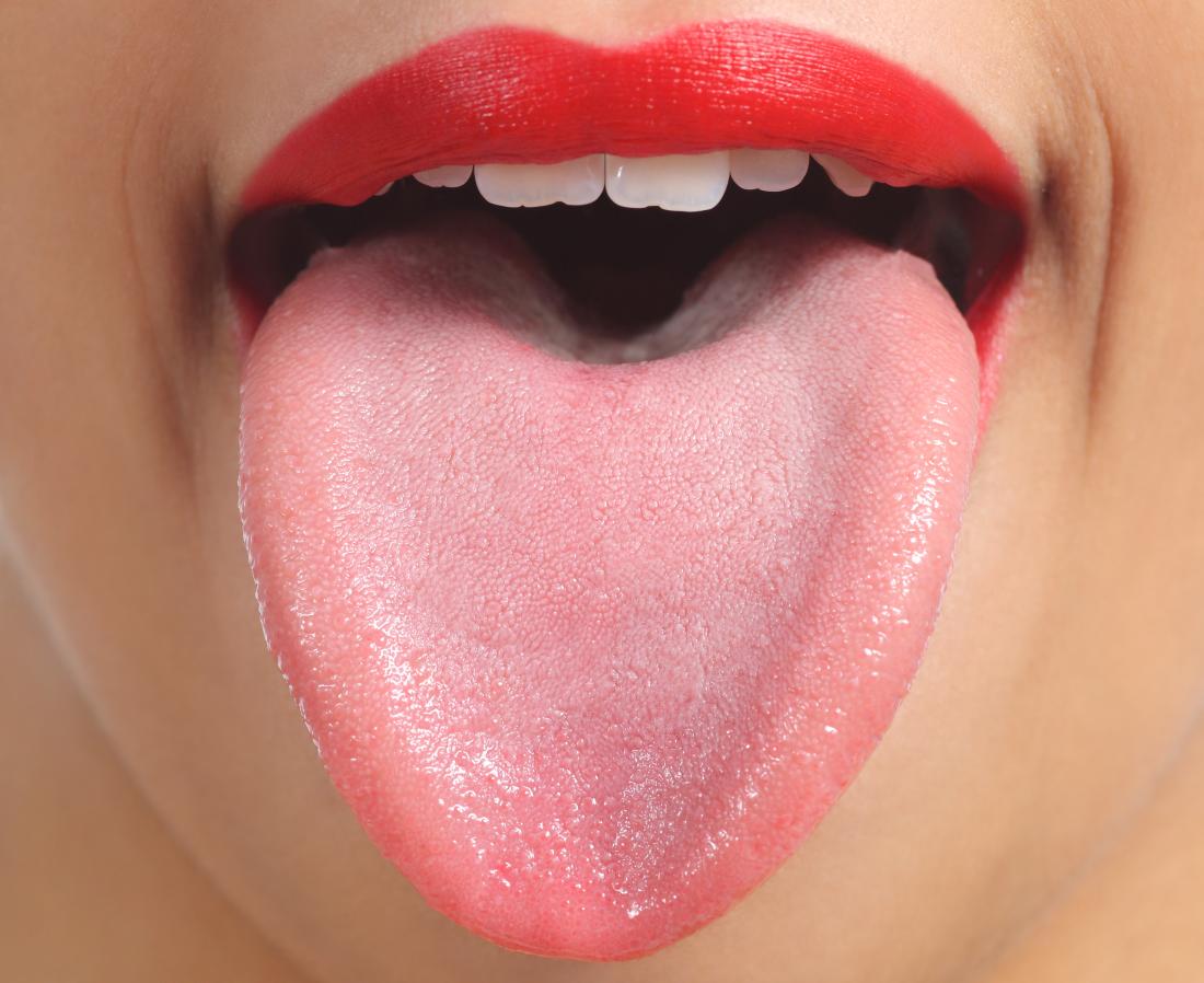 Spots on tongue: Causes and when to see a doctor