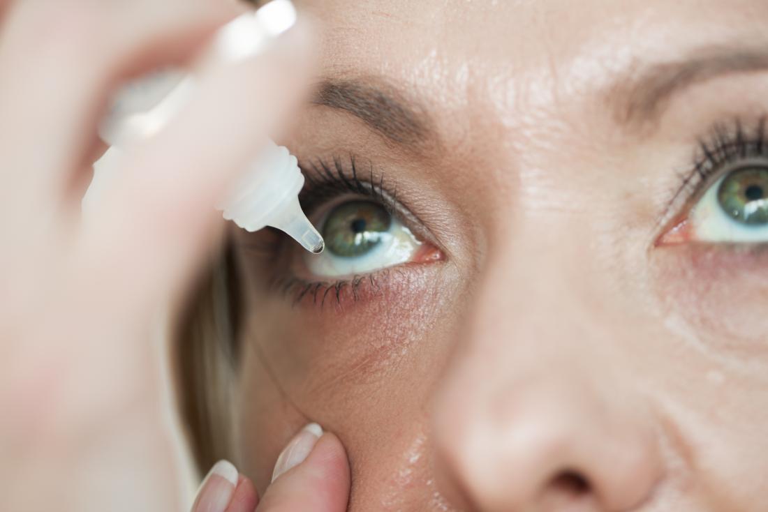 Shingles in the eye Symptoms, treatment, and prevention