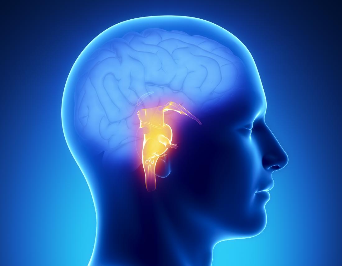 What causes blood clots in the brain?