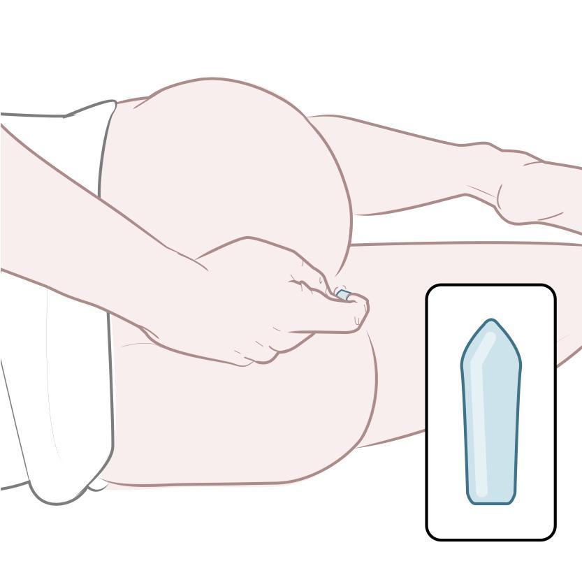 How do suppositories work? Uses, instructions, and pictures