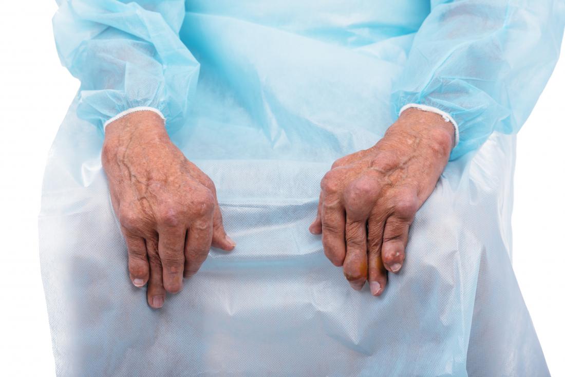 Polyarthritis