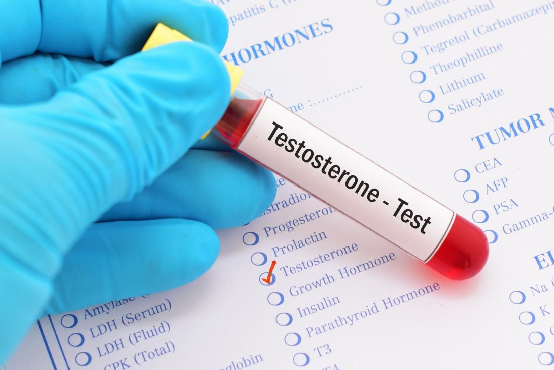 Testosterone normal range in females