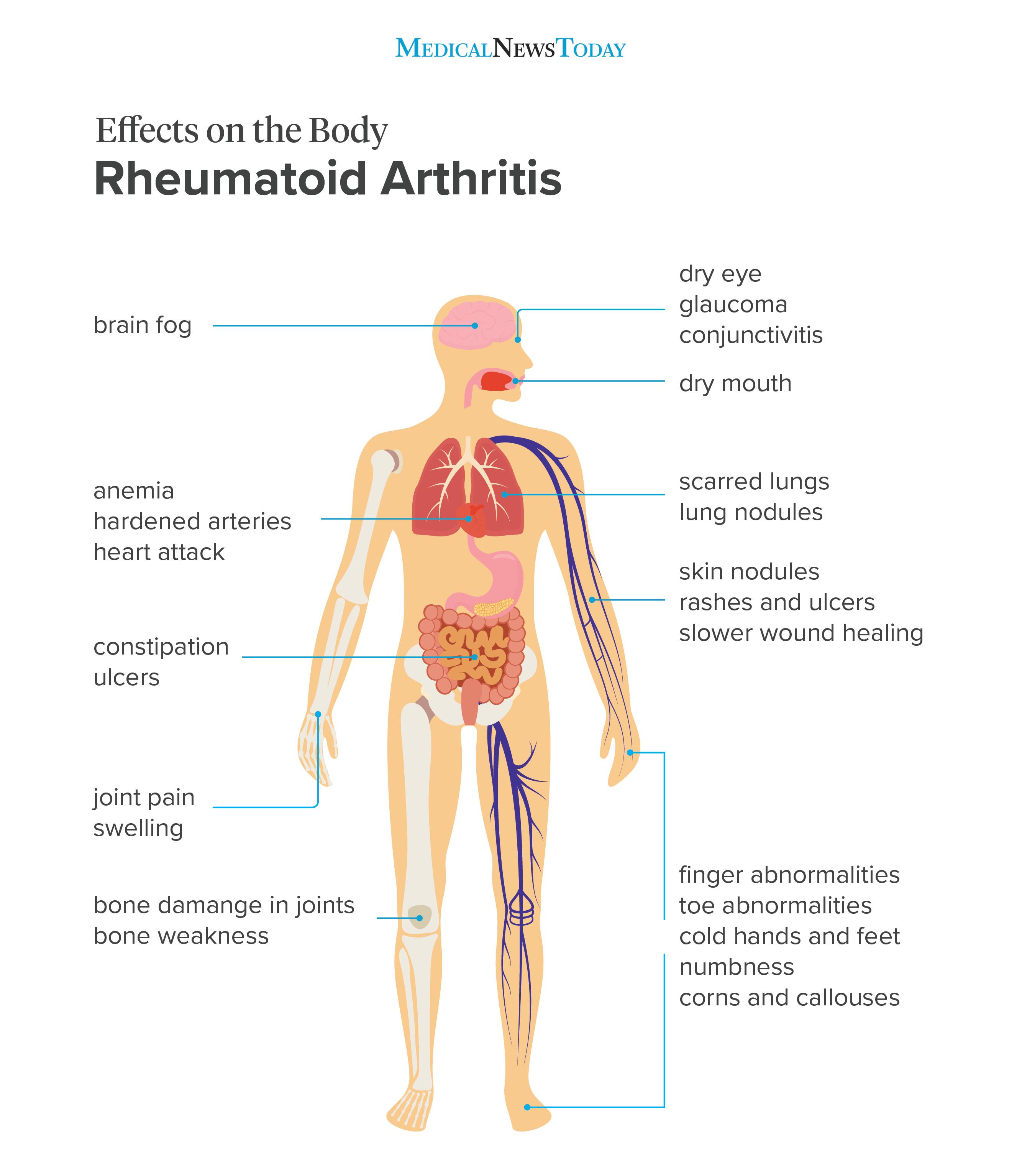 effects on the body of rheumatoid arthritis infographic