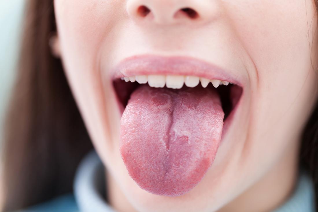 Tongue