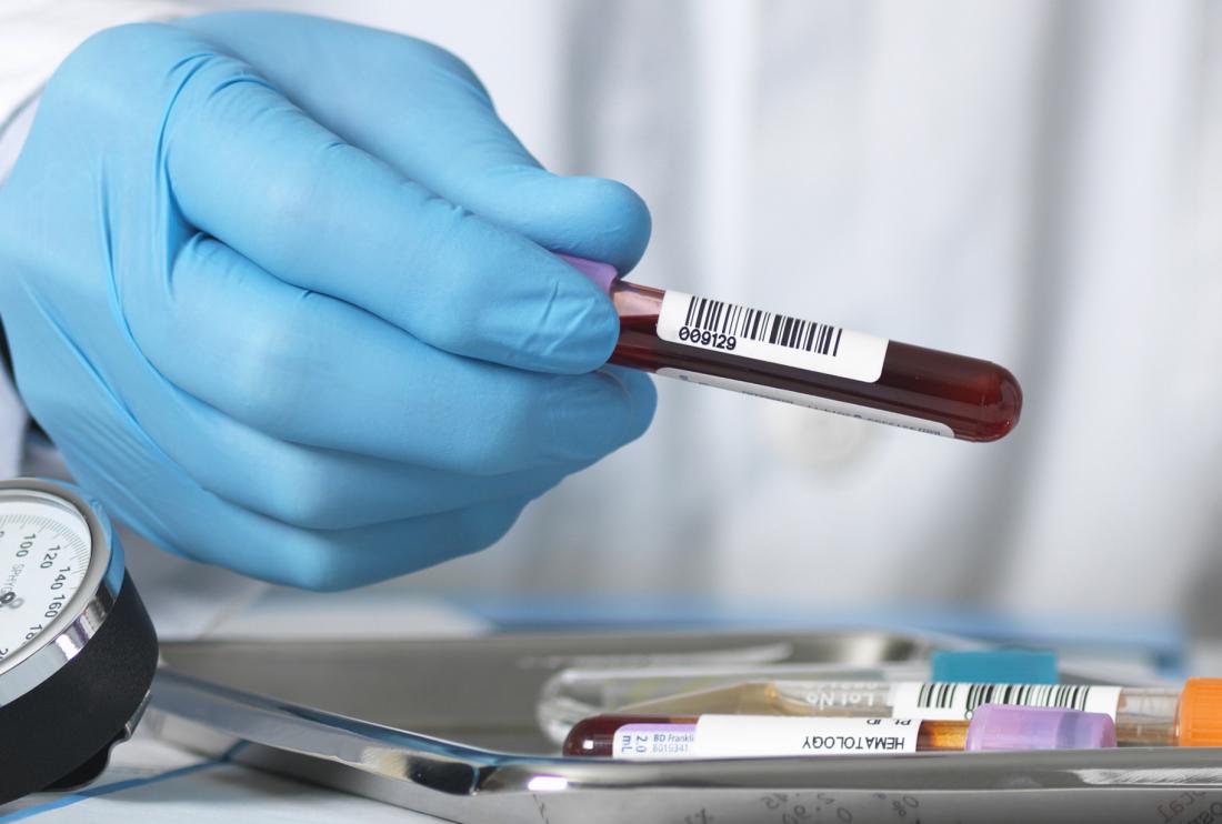 A doctor may recommend a blood test to diagnose RA.