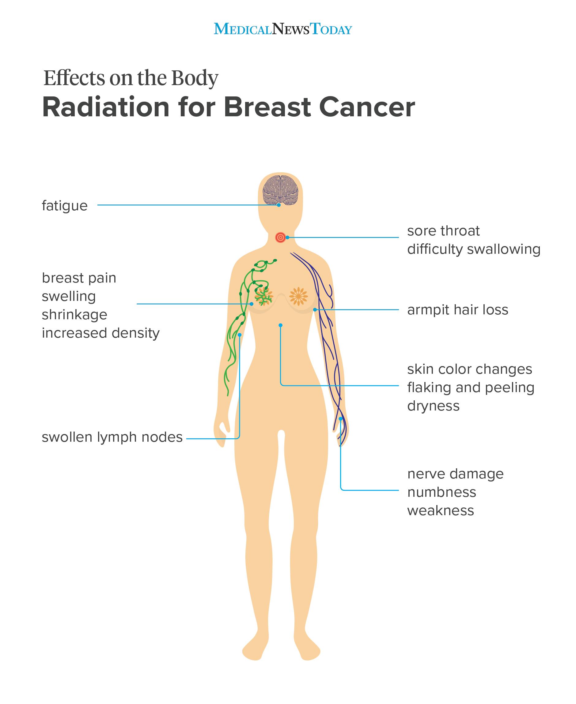 Top 30+ Background Images breast cancer radiation side effects photos Excellent