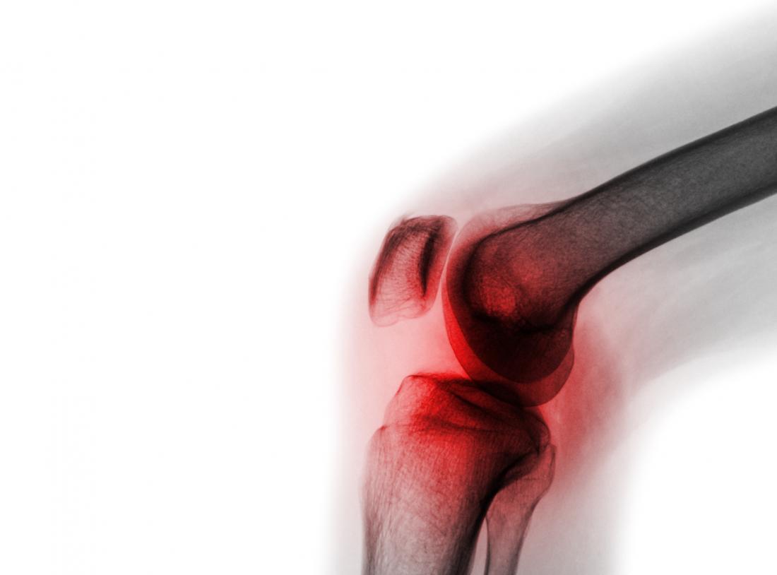x ray of knee joint