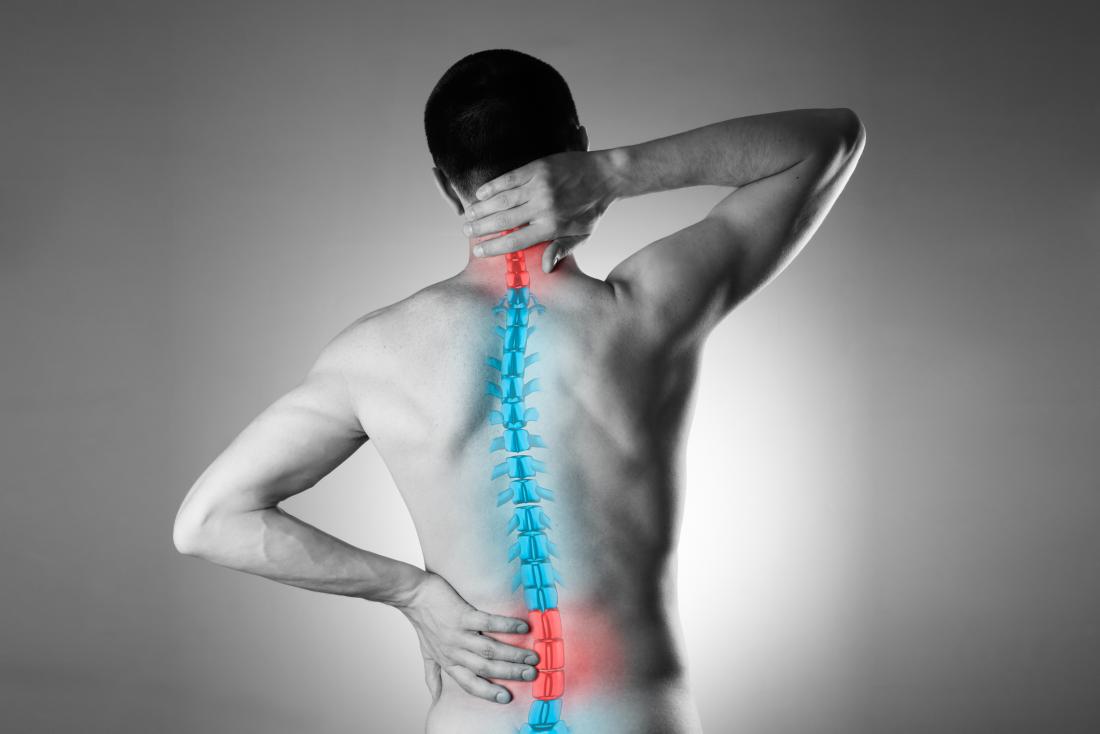 Spinal Stimulation - How it Works & When it Helps