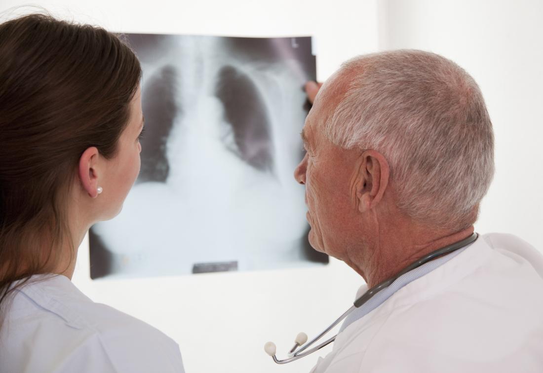 Doctor and COPD patient looking at x-ray of lungs.