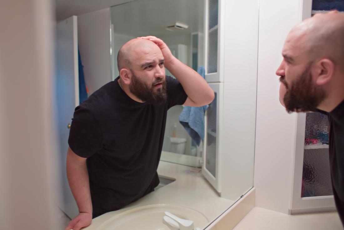man examines hair loss<!--mce:protected %0A-->