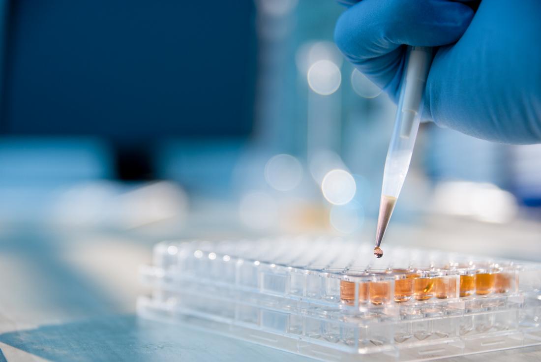 lab test concept photo