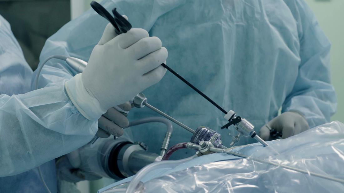 laparoscopy