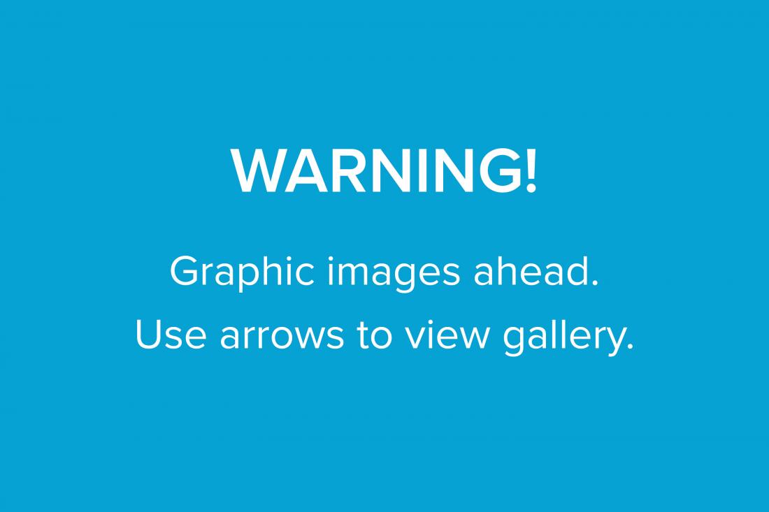 Warning