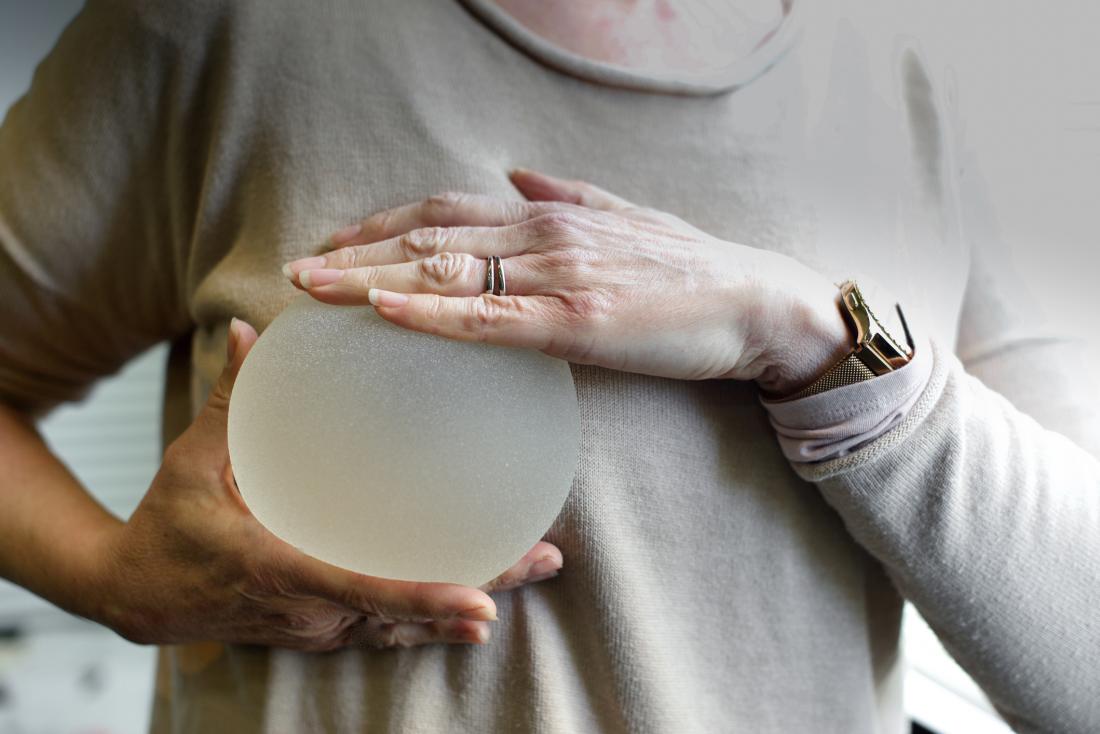 The long term outcomes of breast implants studied