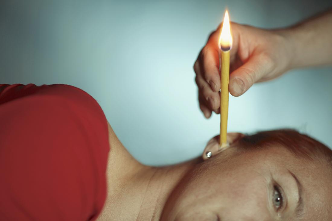 ear candling being used on a woman