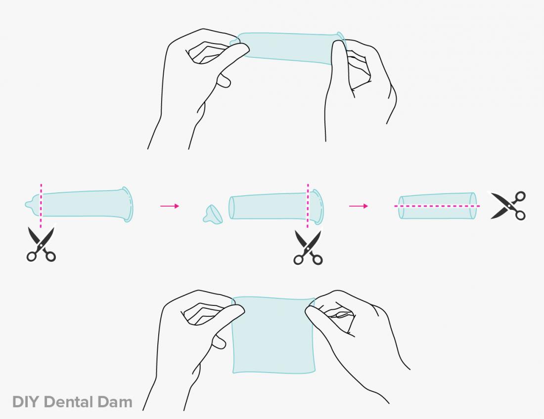 Dental Dams - Teen Health Source