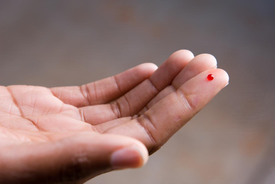 Can you get infected with HIV from a manicure? The likelihood of contracting HIV from manicure 