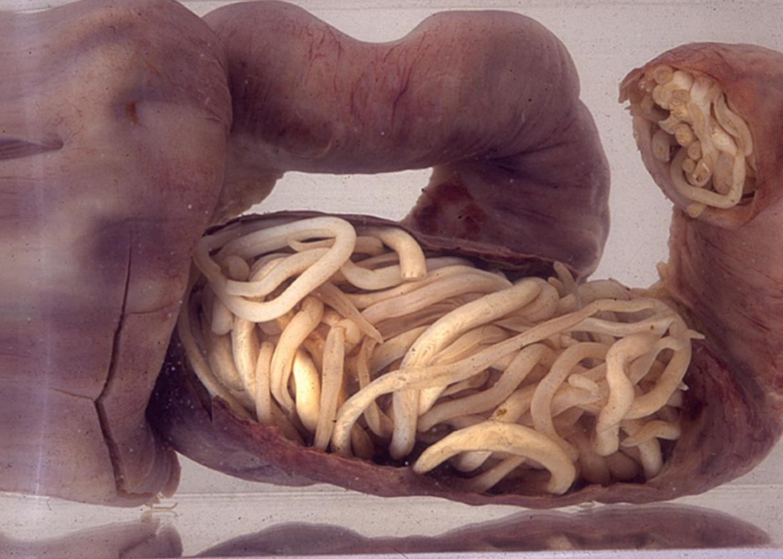 Intestinal worms: Pictures, symptoms, and treatment1100 x 786