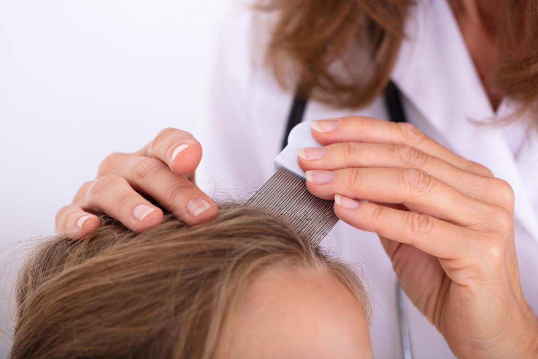 Lice vs. dandruff: Differences, pictures, and symptoms