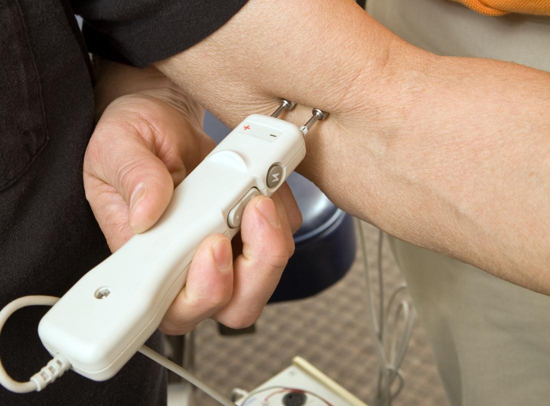 Nerve conduction velocity test being applied to arm.