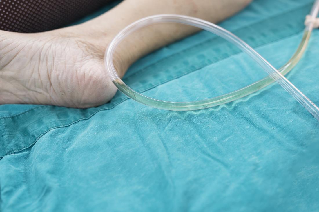 Life with Catheter Supplies: Cleaning Your Urinary Drainage Bag