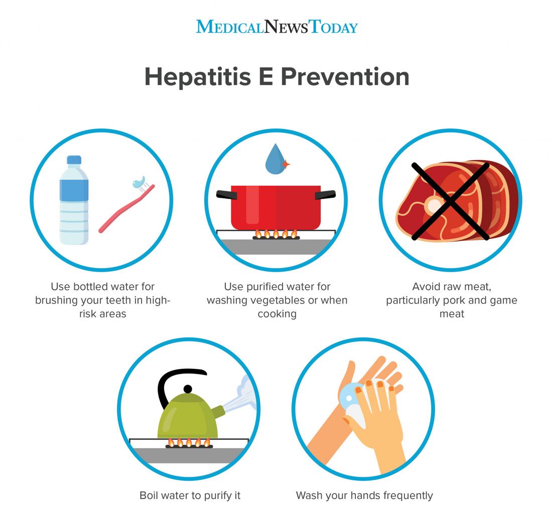 Infográfico de hepatite E