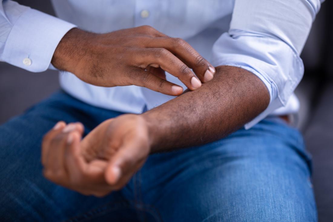 Man itching his arm