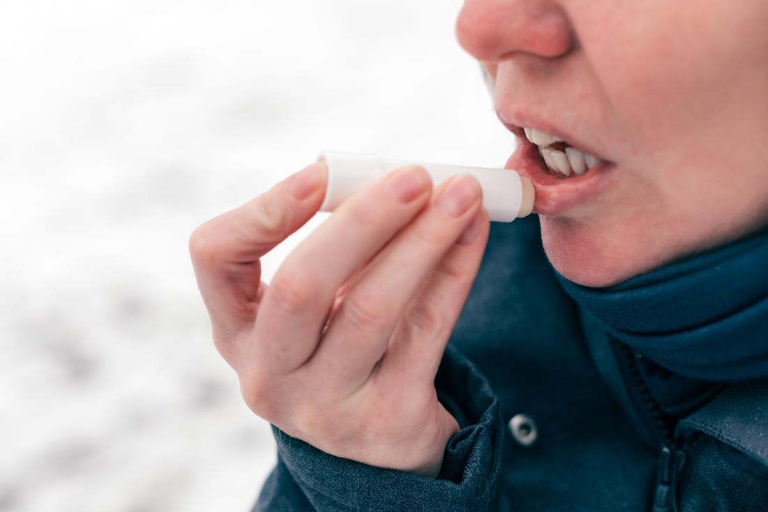 The best natural lip balms to save your dry, chapped lips this winter