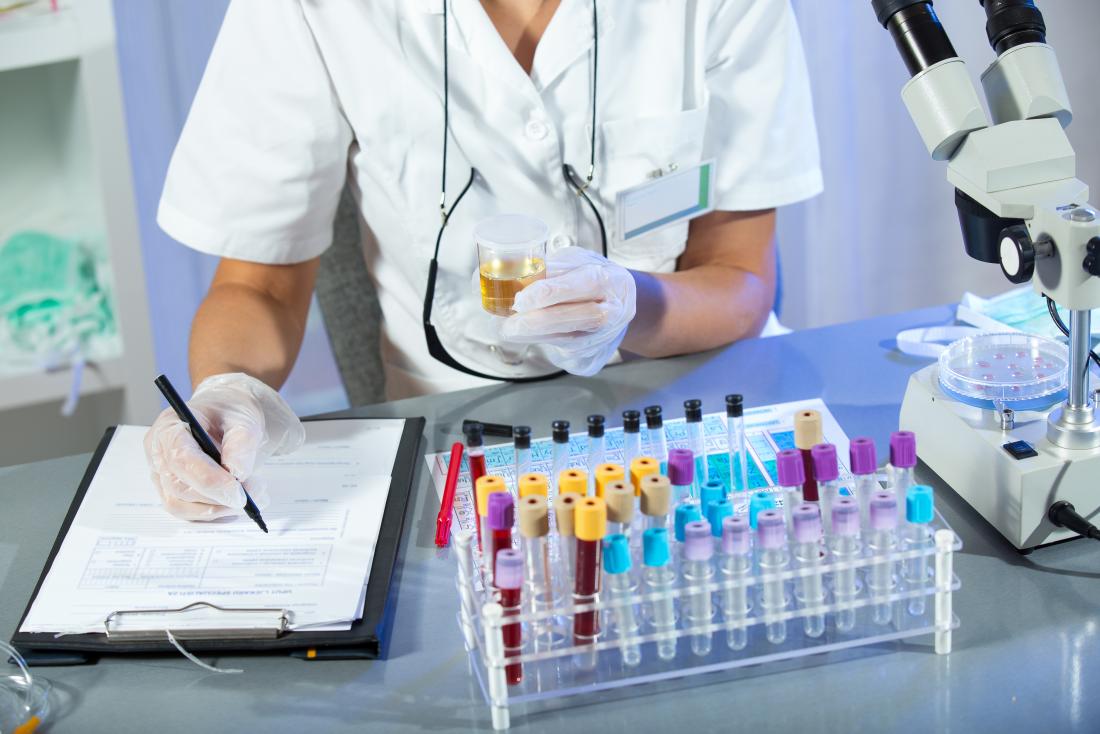 urine being tested in a lab
