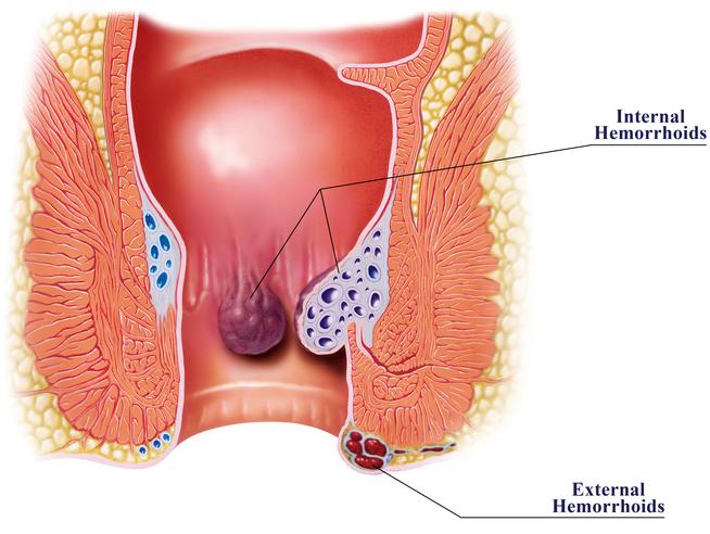 Is Anal Sex Pleasurable